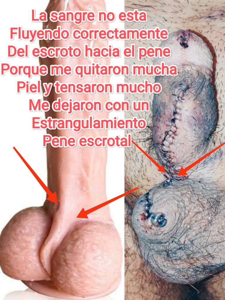 urologo mariano oropeza medica sur